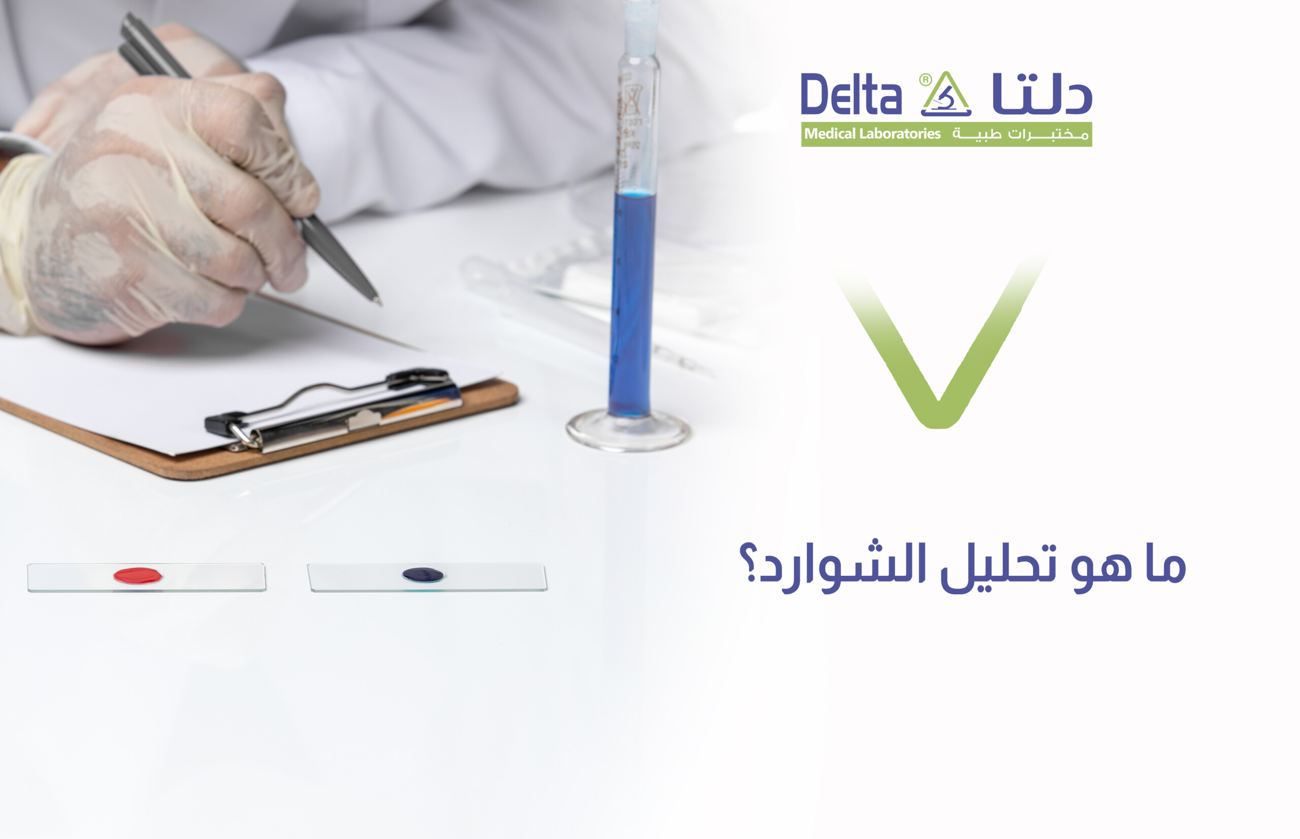 تحليل الشوارد