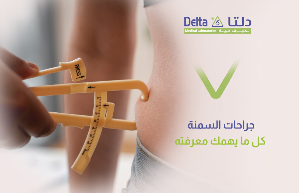 جراحات السمنة دليل تعريفي شامل