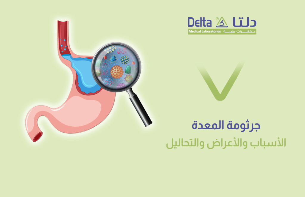 جرثومة المعدة