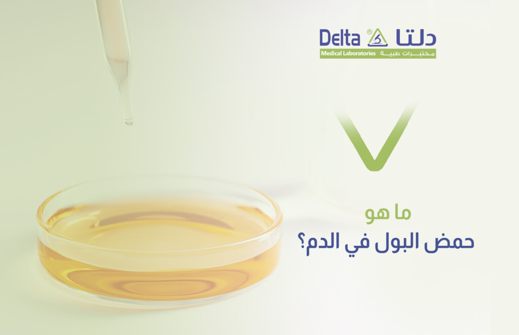 تحليل حمض البول