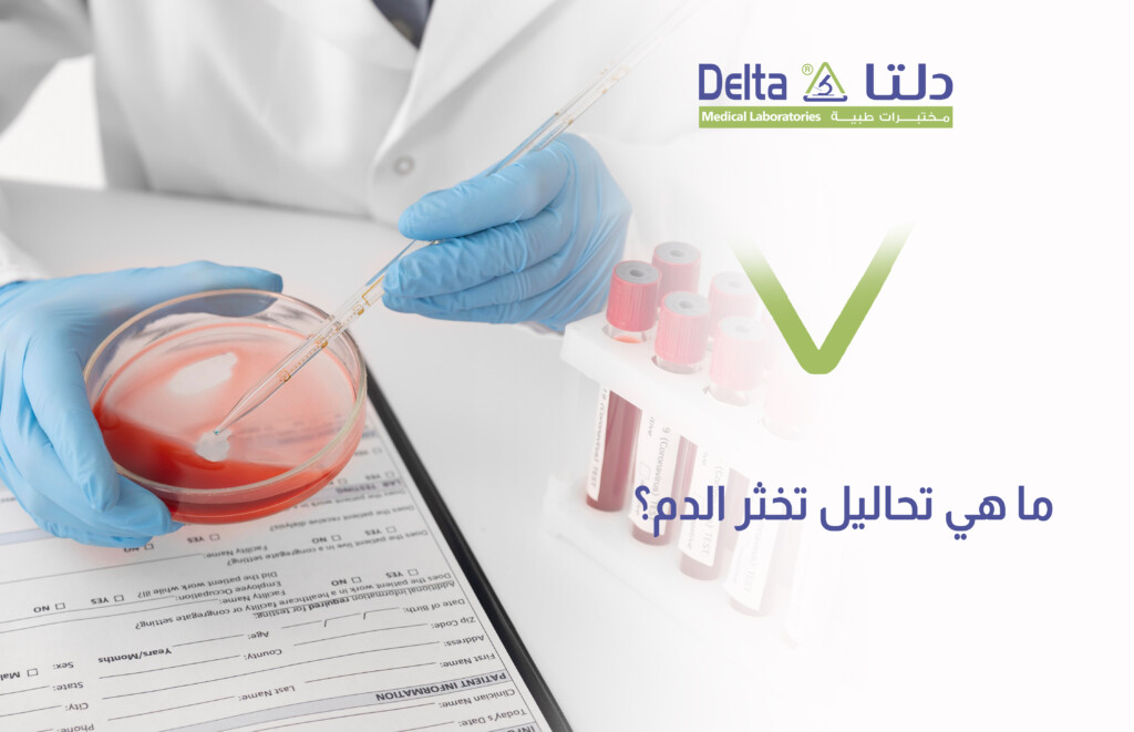 ما هو تحليل تخثر الدم