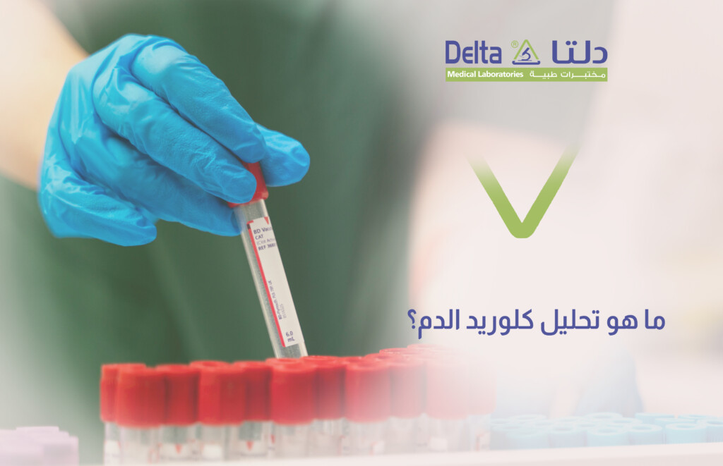 مقال تعريفي كامل عن تحليل كلوريد الدم