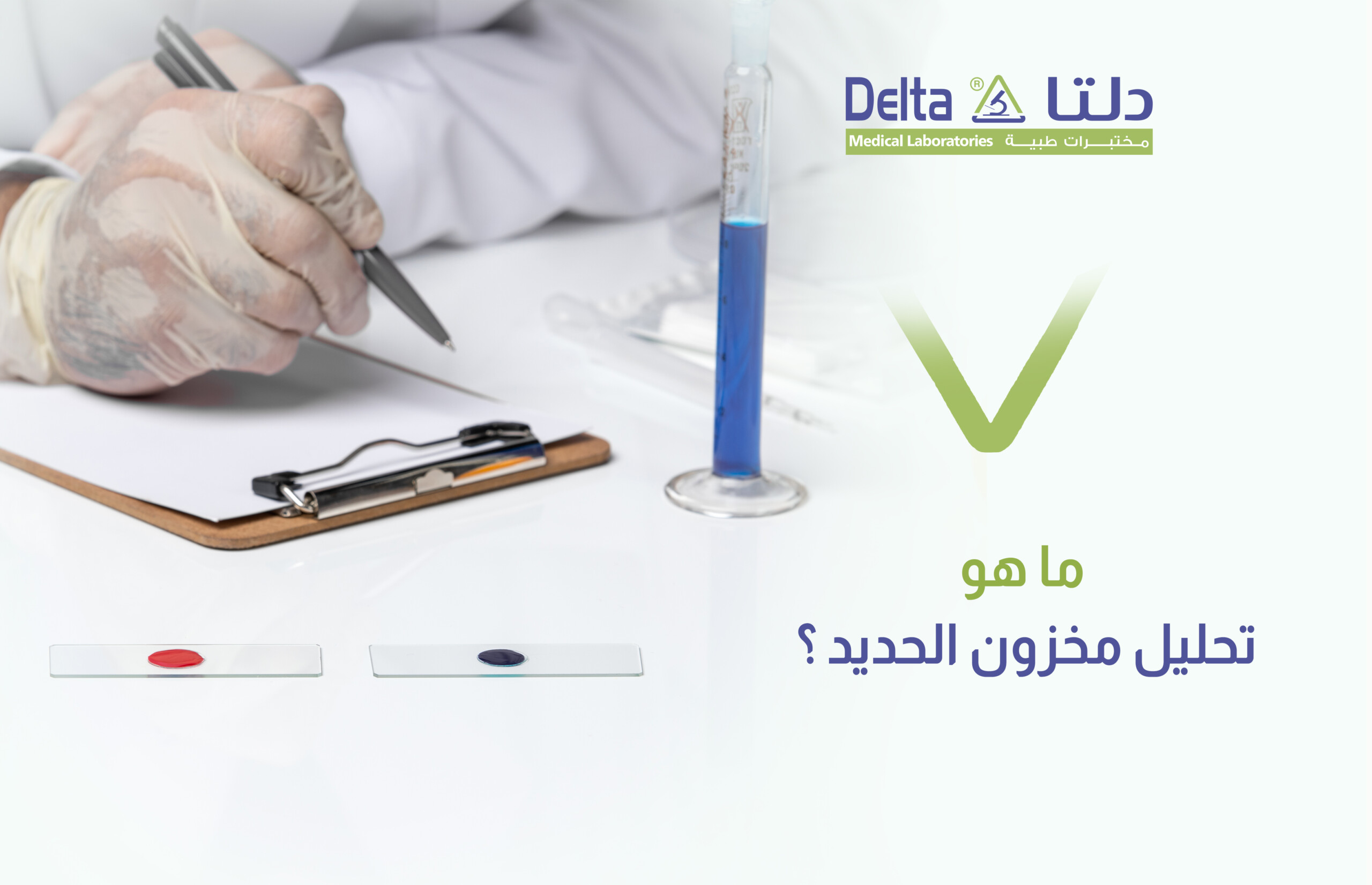 ما هو تحليل مخزون الحديد