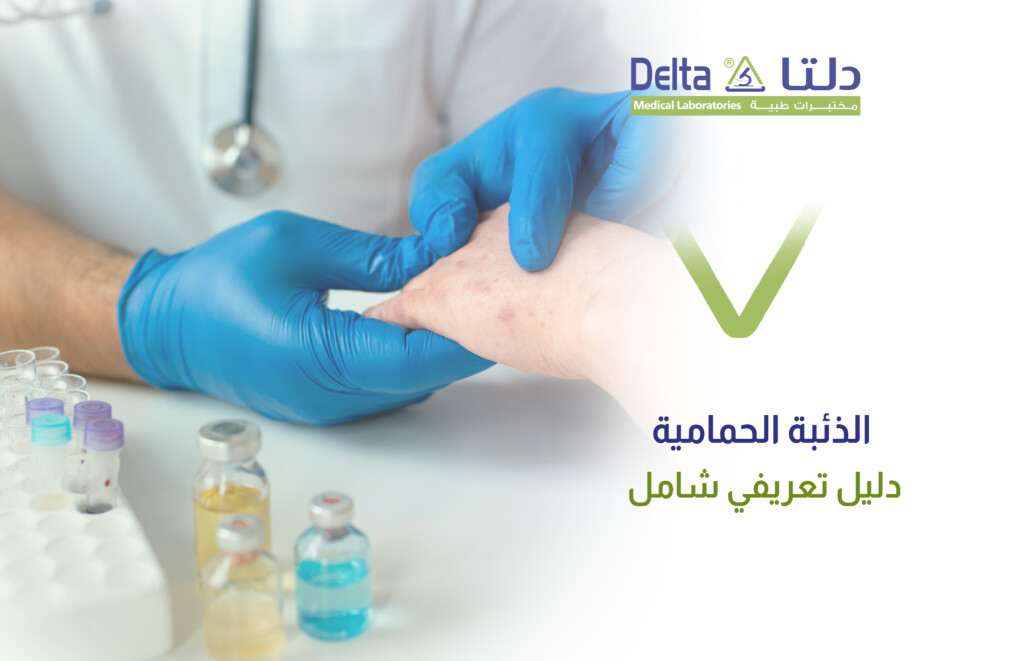 ما هو مرض الذئبة الحمامية