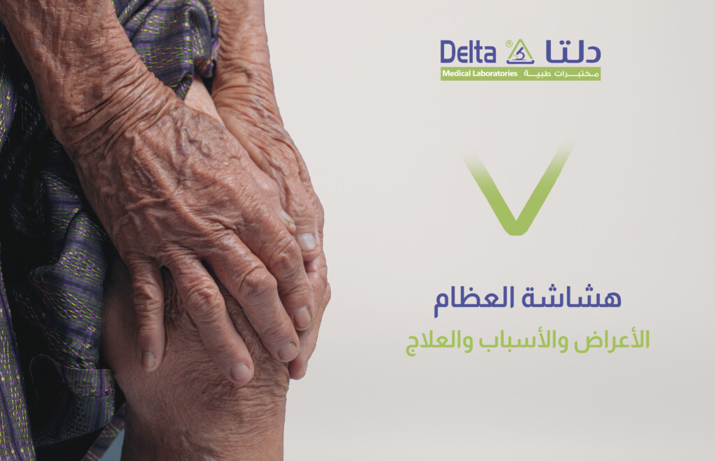 هشاشة العظام