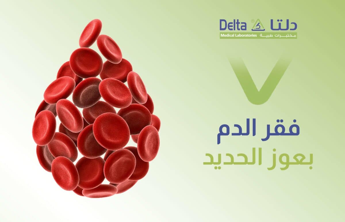 فقر الدم بعوز الحديد ، الأعراض والأسباب والعلاج