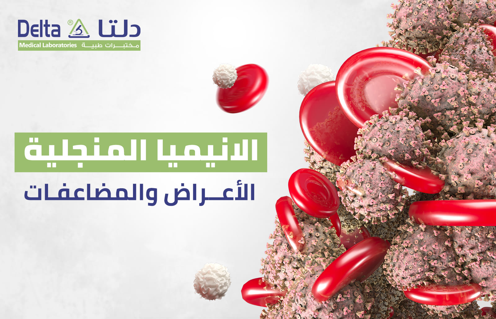 الانيميا المنجلية: الأعراض والمضاعفات