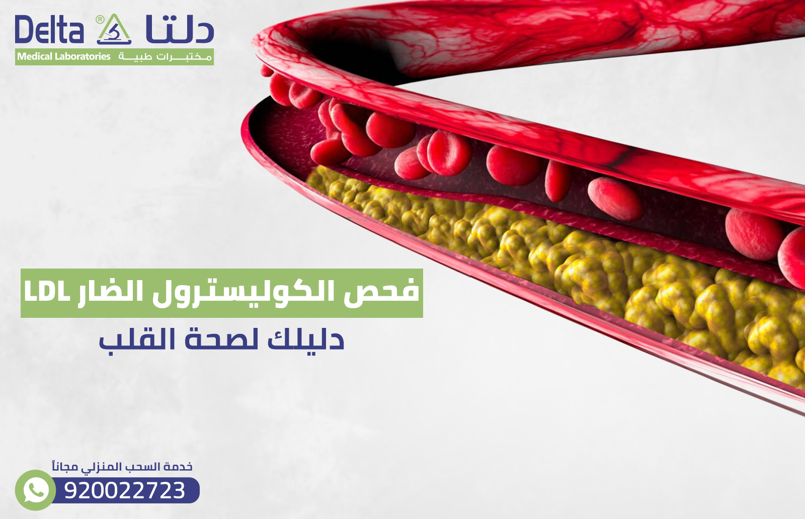 فحص الكوليسترول الضار LDL: دليلك لصحة القلب