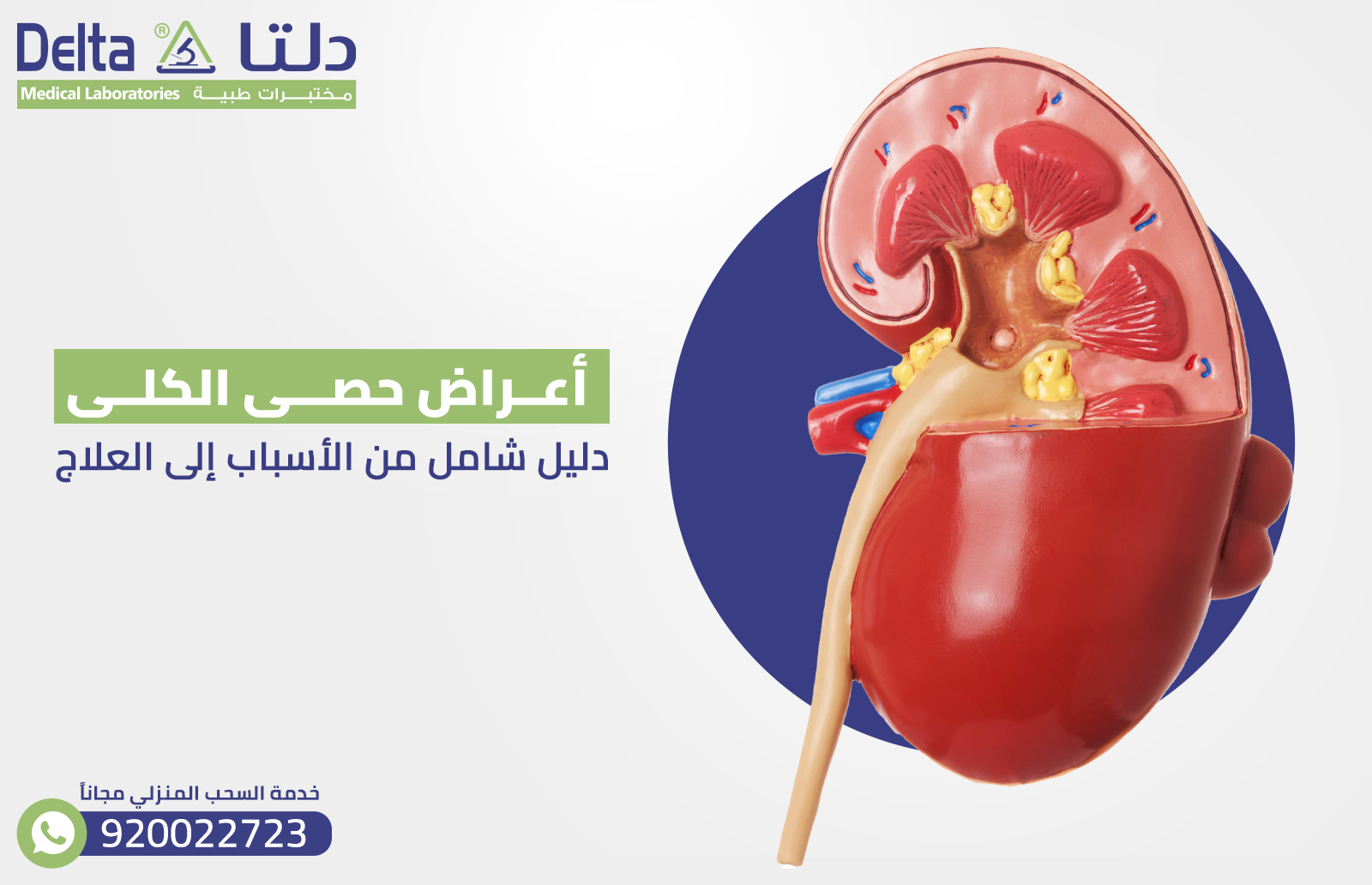 أعراض حصى الكلى : دليل شامل من الأسباب إلى العلاج