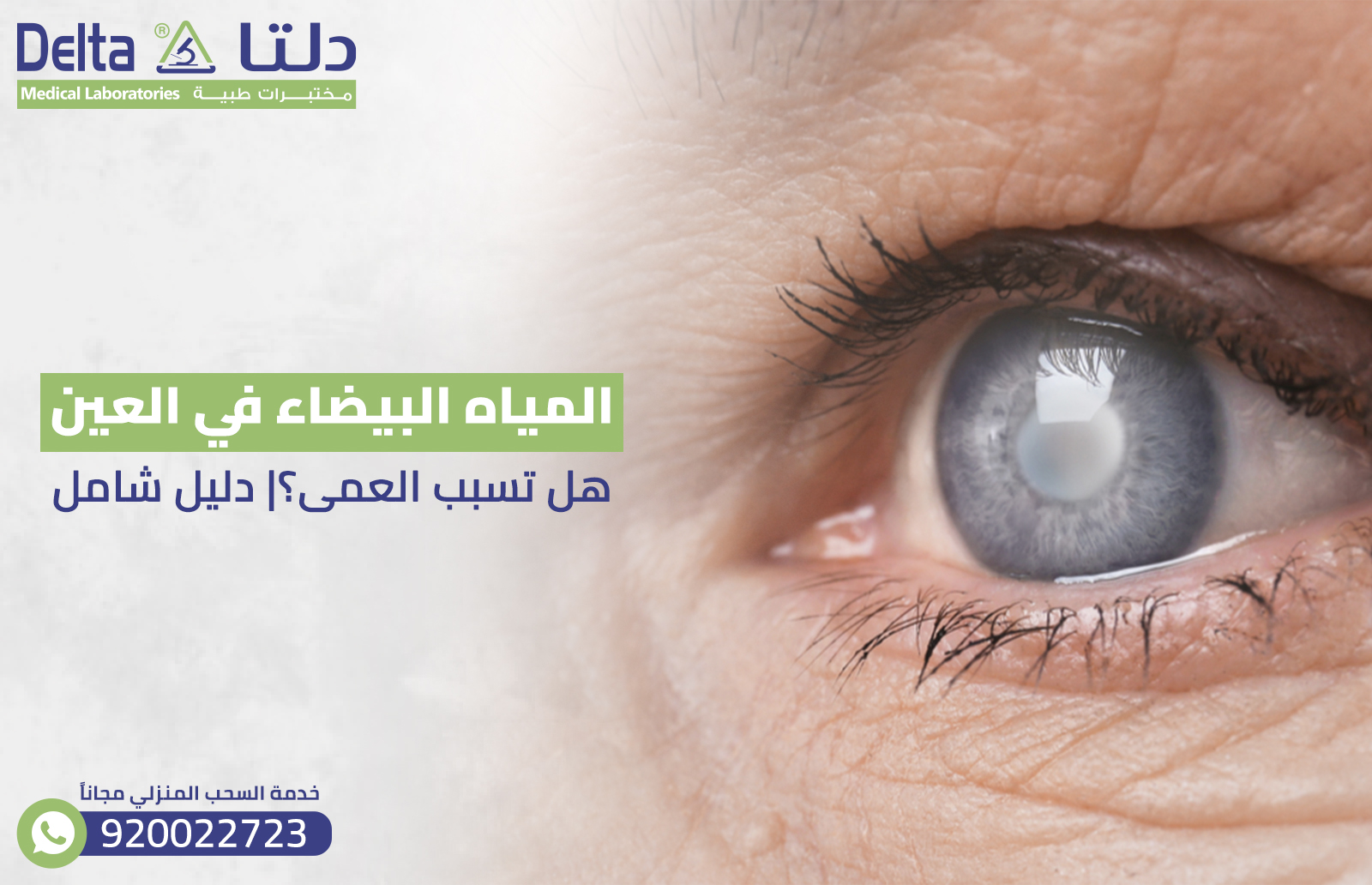 المياه البيضاء في العين : هل تسبب العمى؟| دليل شامل 