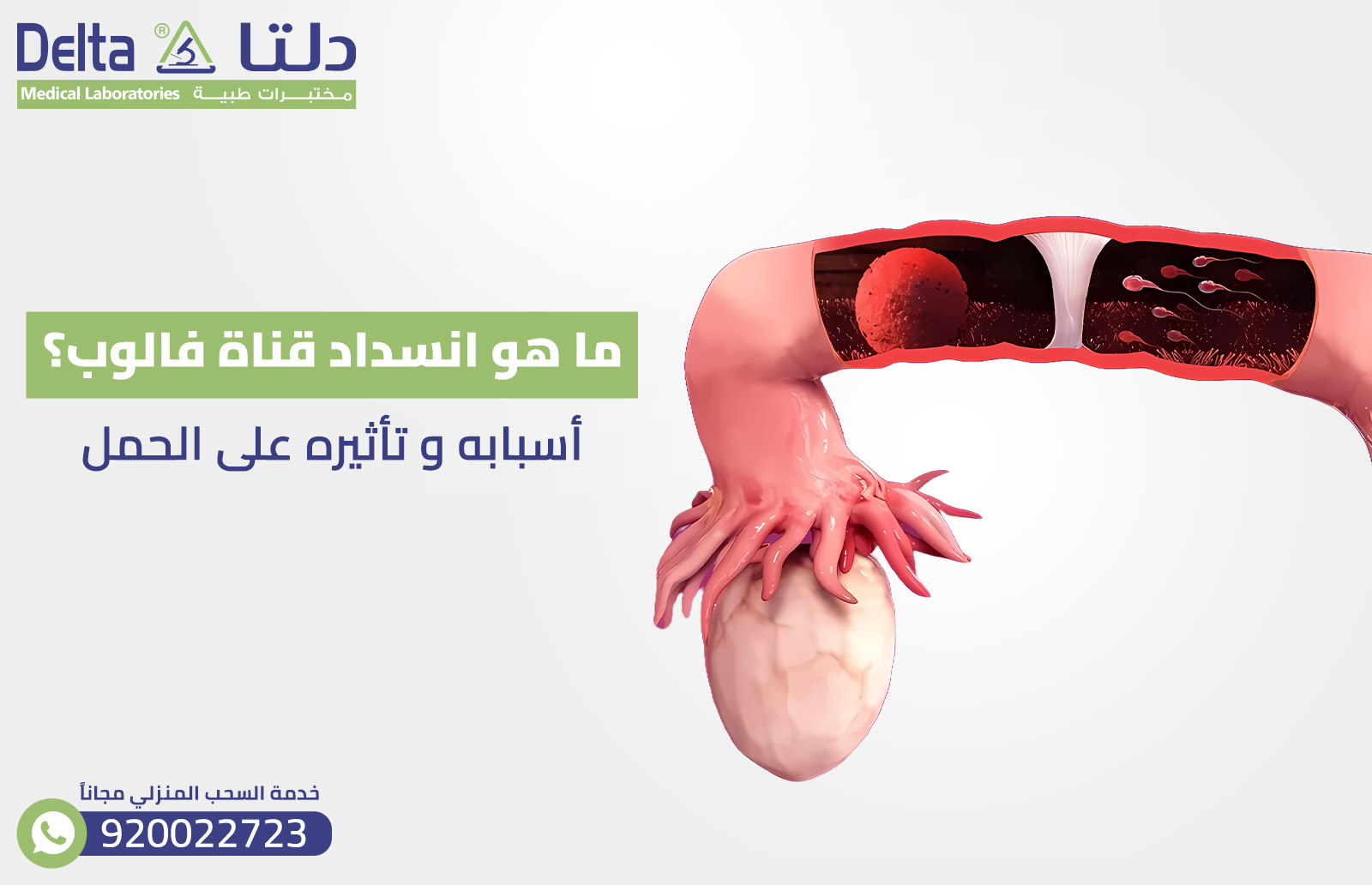 ما هو انسداد قناة فالوب ؟ أسبابه و تأثيره على الحمل