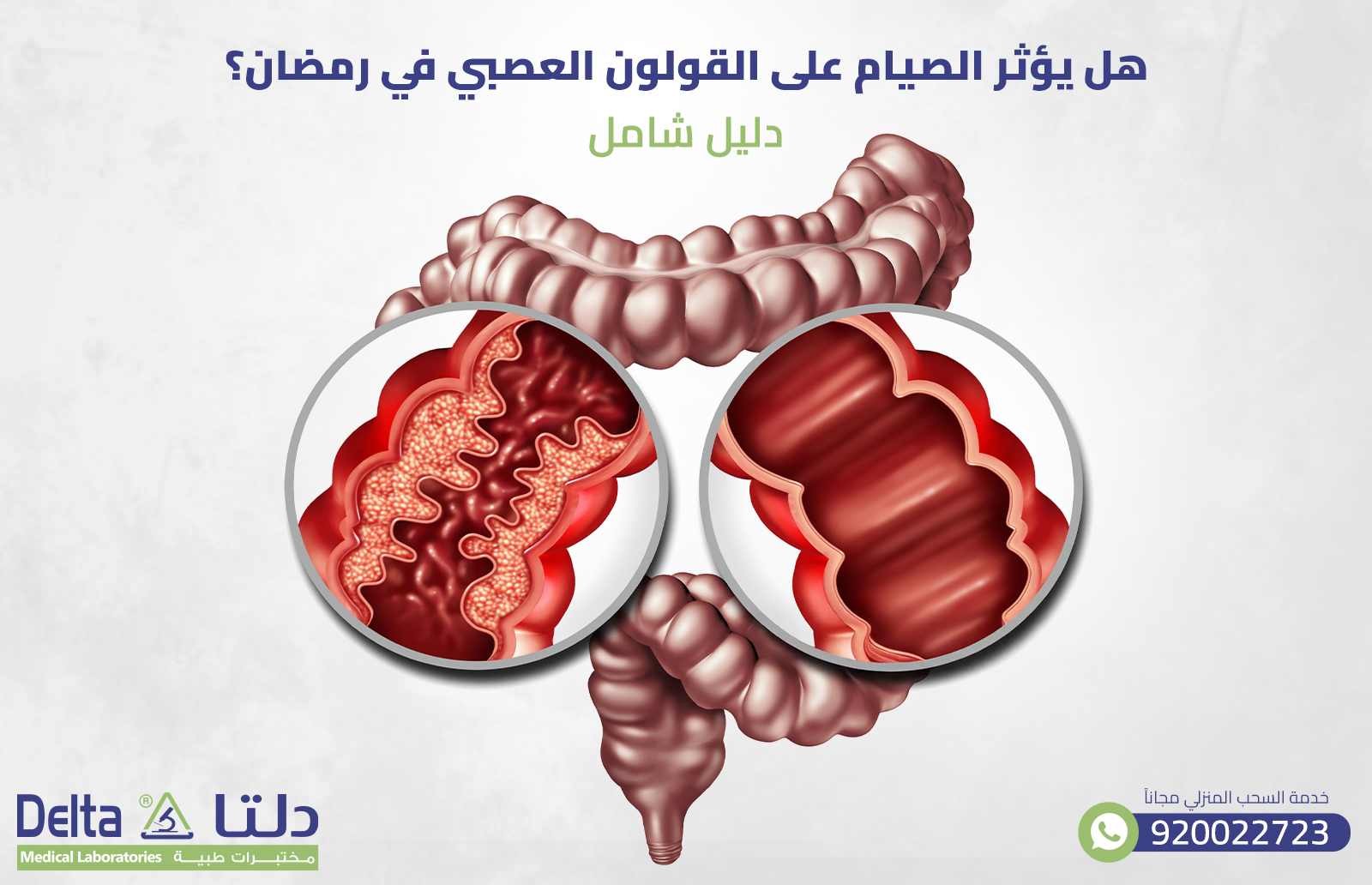 هل يؤثر الصيام على القولون العصبي في رمضان؟ دليل شامل