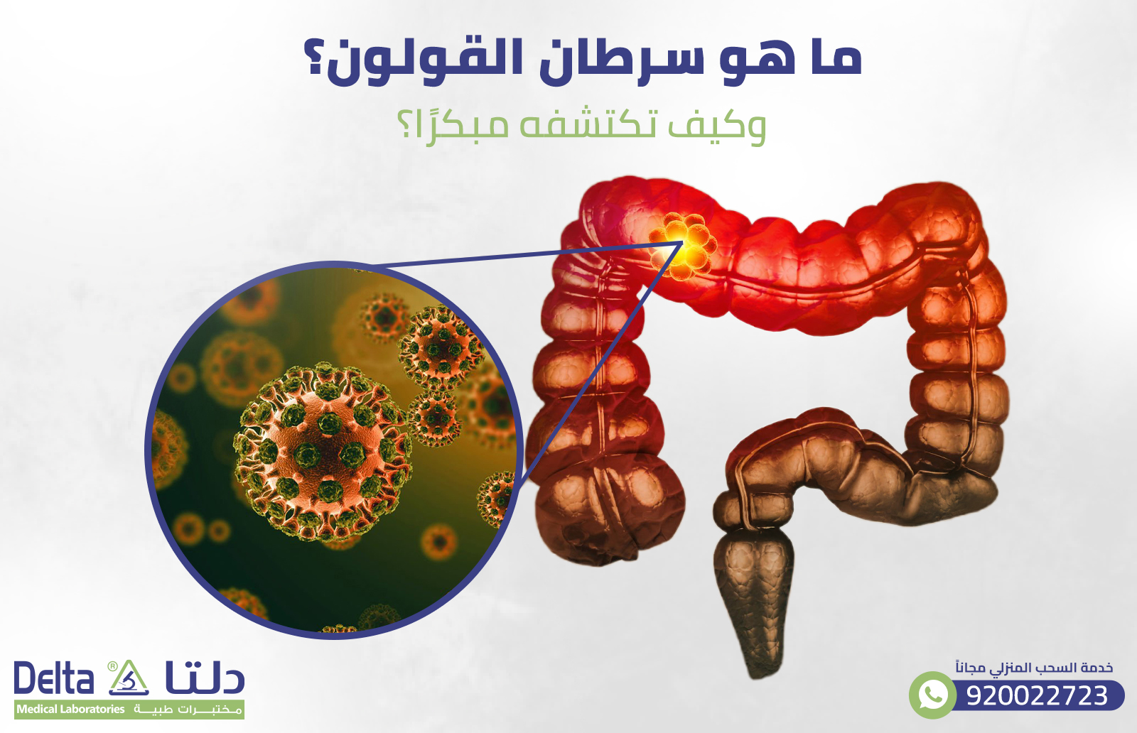 ما هو سرطان القولون؟ وكيف تكتشفه مبكرًا؟