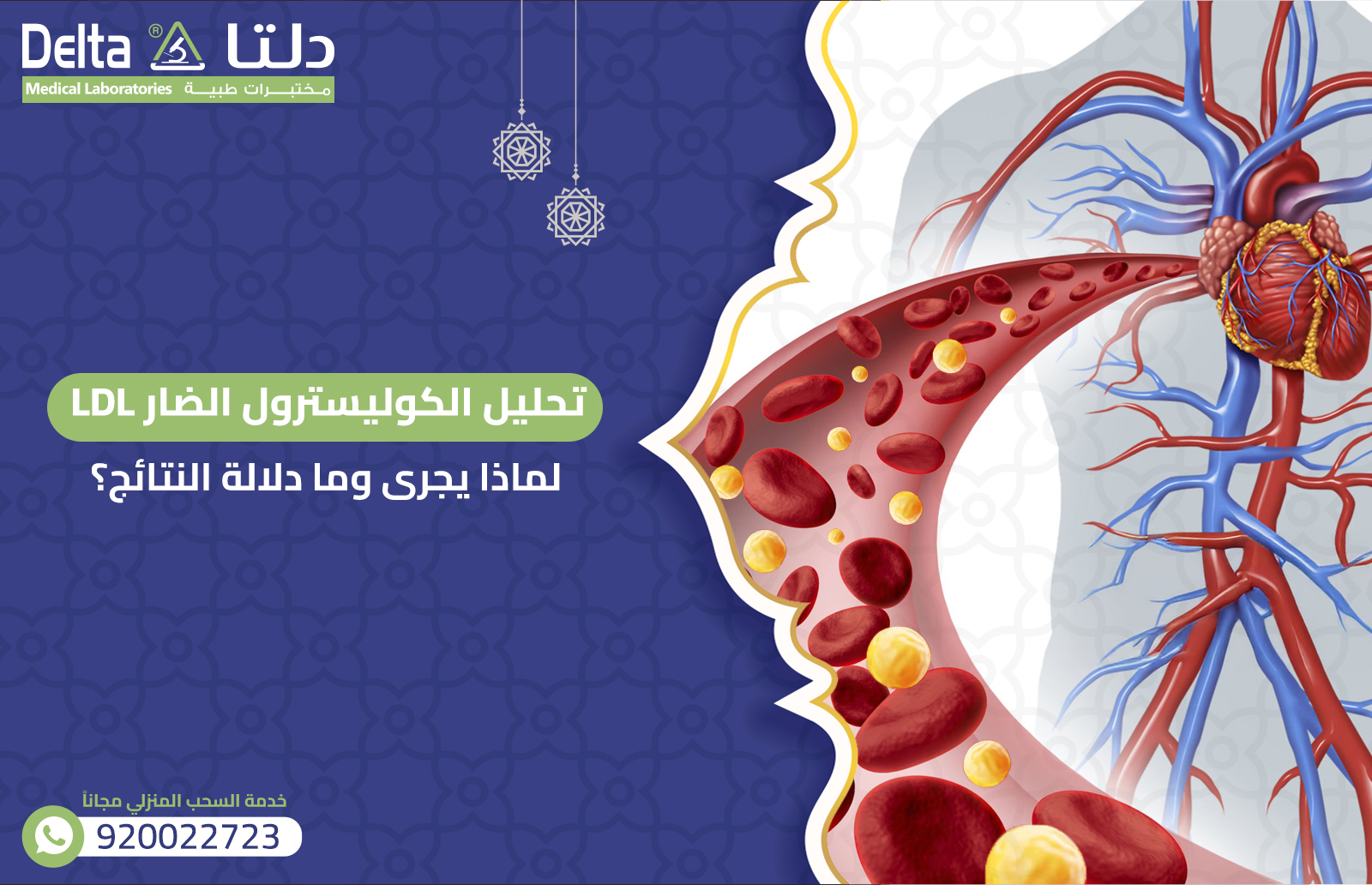 تحليل الكوليسترول الضار LDL: لماذا يجرى وما دلالة النتائج؟