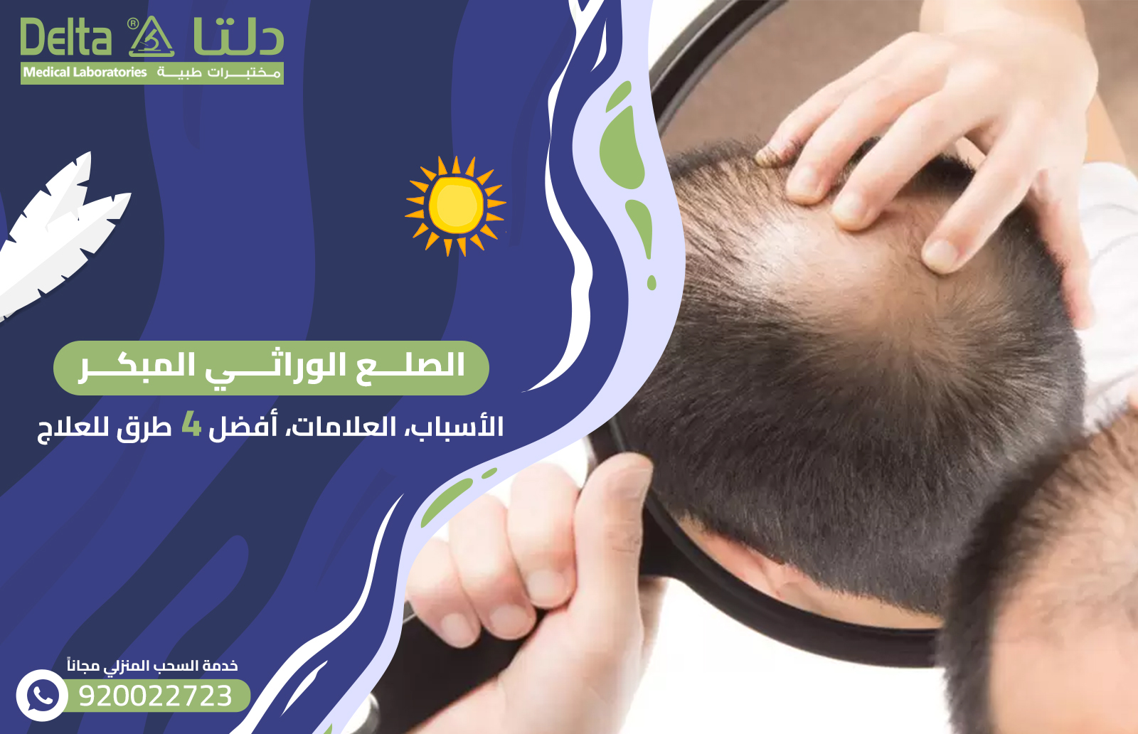 الصلع الوراثي المبكر