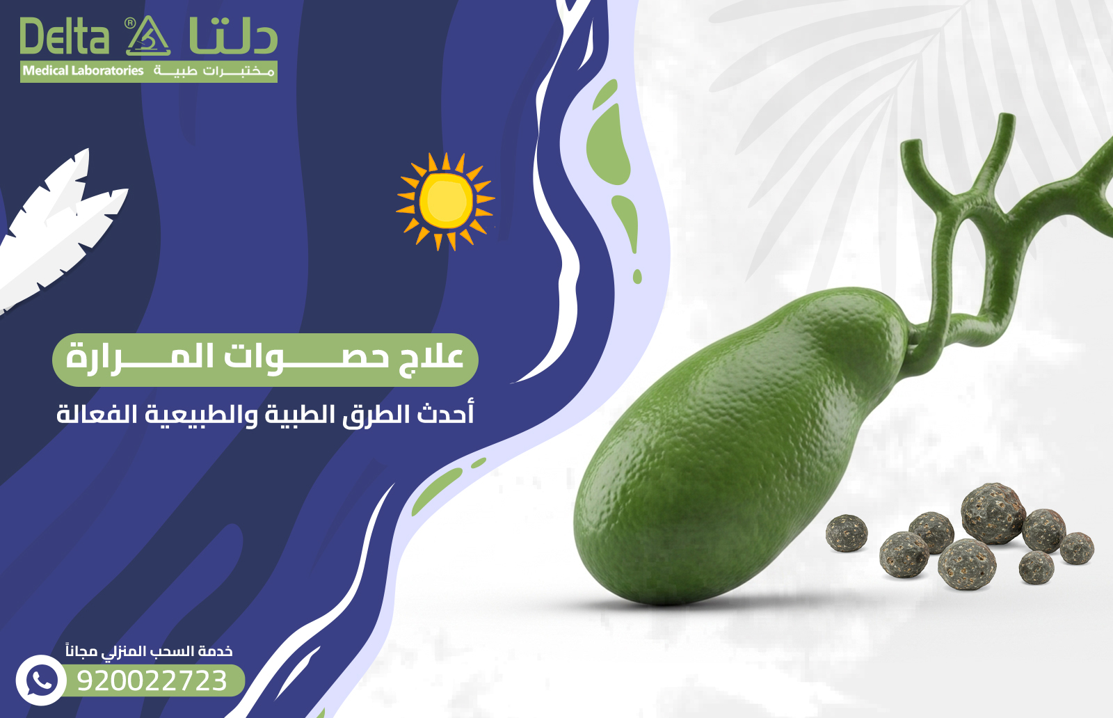 علاج حصوات المرارة