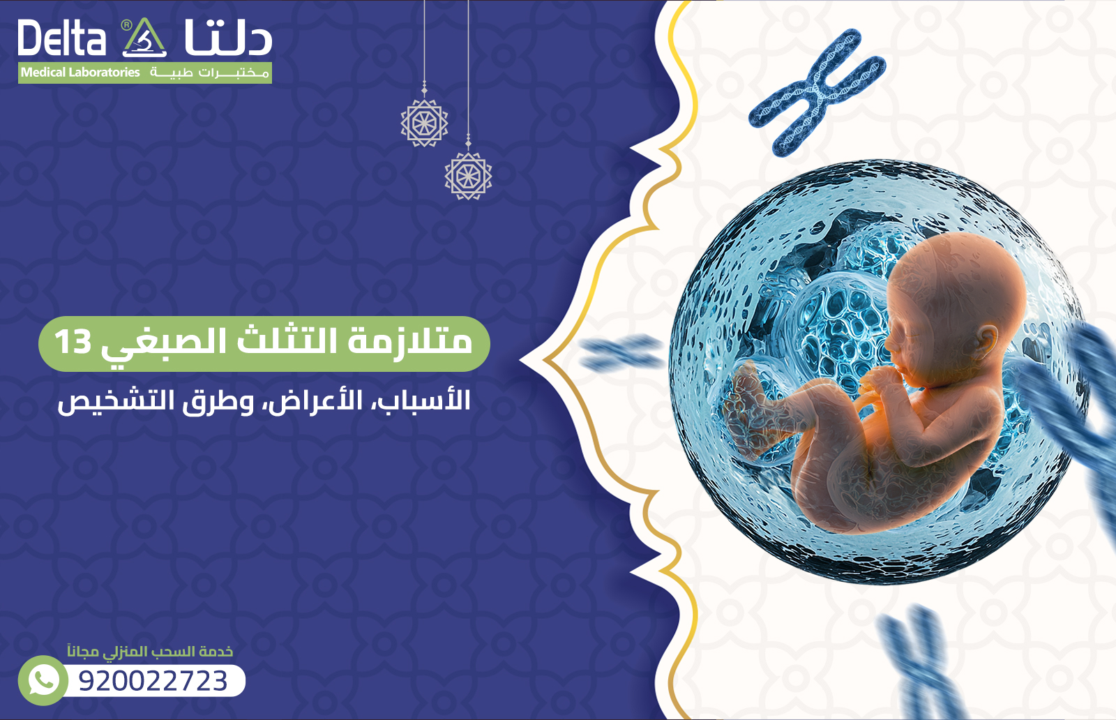 متلازمة التثلث الصبغي 13