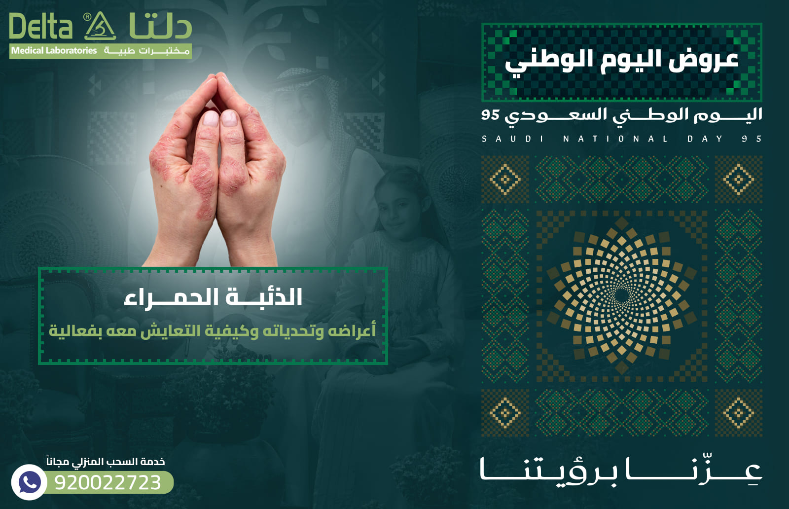 الذئبة الحمراء