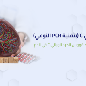 تحليل الكبد الوبائي C ( بتقنية PCR النوعي )