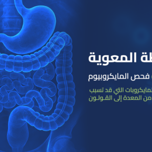 باقة الخارطة المعوية